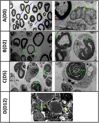 Development and Characterisation of an in vitro Model of Wallerian Degeneration